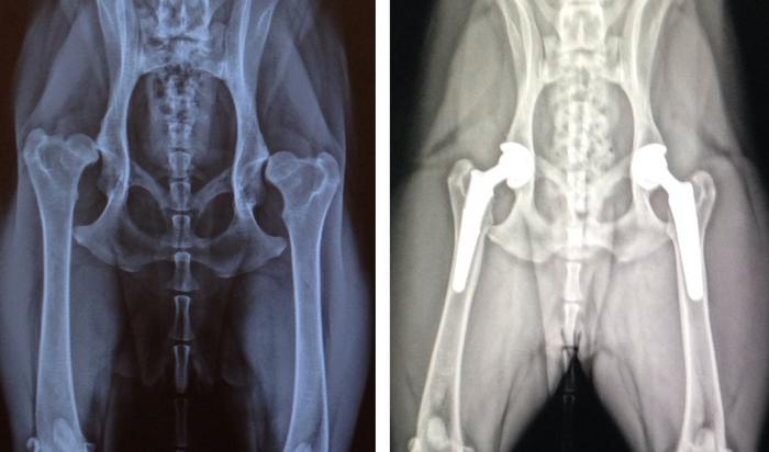 Hip Xrays