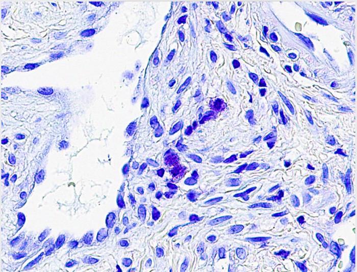 Mast cells sinus tissue