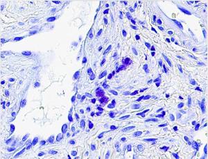 Mast cells sinus tissue