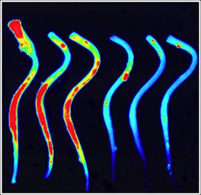 Thrombin Activity in Spinal Column