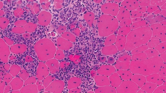 Muscle tissue