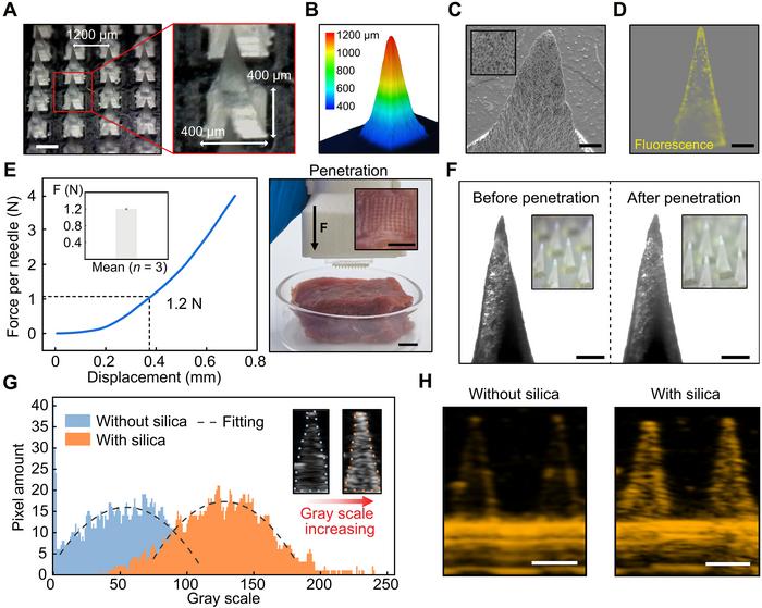 PolyU develops wearable microneedle patch to empower conventional ultrasound for continuous glucose monitoring