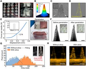 PolyU develops wearable microneedle patch to empower conventional ultrasound for continuous glucose monitoring