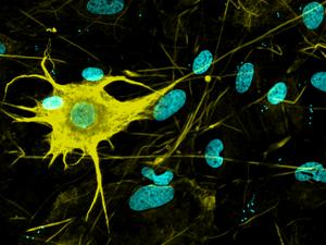 Nerve cell