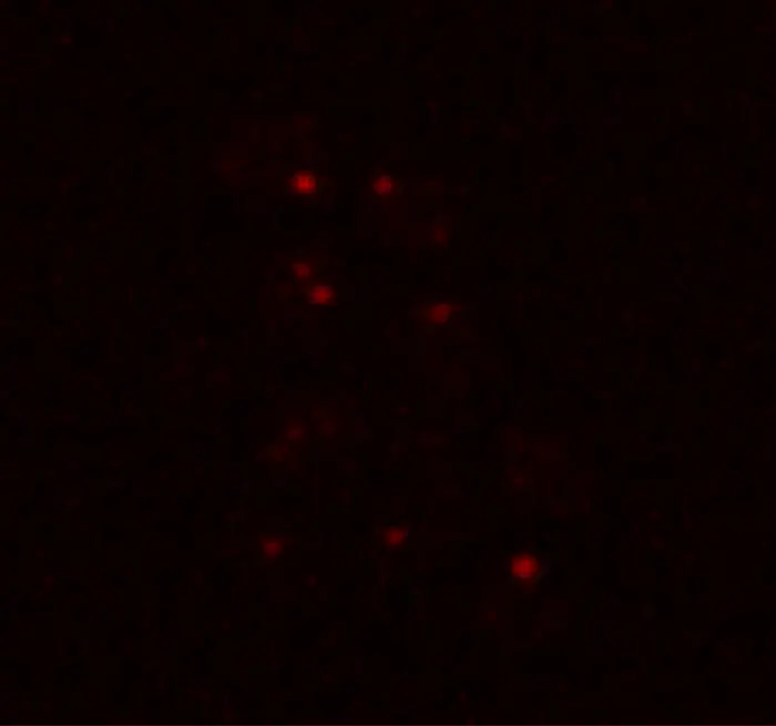 Yeasts in Martian conditions