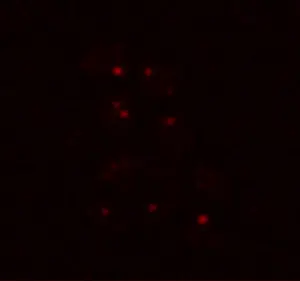 Yeasts in Martian conditions