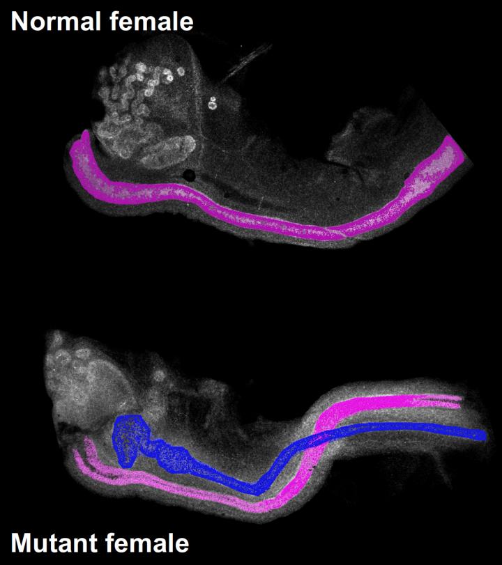 Breaching the Sexual Differentiation Paradigm for Reproductive Tract Development (2 of 2)