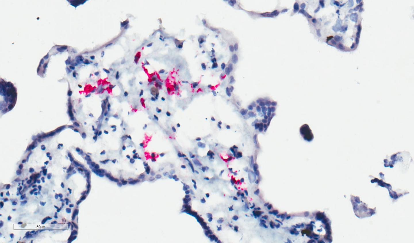 Zika Infection of Placental Macrophages