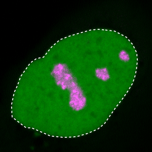 Nucleus of a healthy human cell