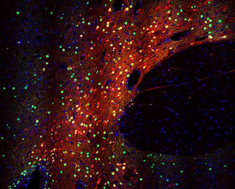 Turning on a Selected Gene in the Rat Brain