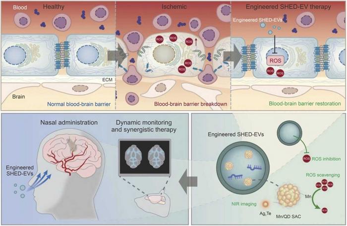 Engineered Stem Cell Vesicles for Real-Time Stroke Imaging and Therapy