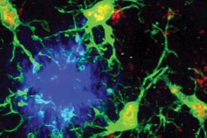 Protective microglia attack plaques in mouse brain