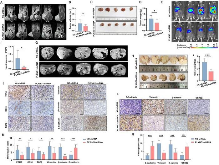 PLXNC1 promotes tumor growth and metastasis in vivo