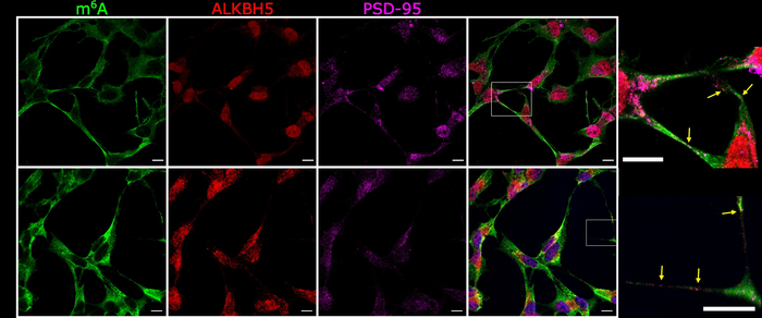 Demethylation of RNA messages occurs during synaptic activation