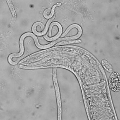 Unraveling the Elephantiasis Worm Genome (2 of 4)