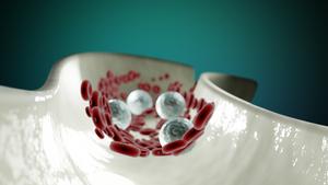 Genetic study in Indians finds new pathways involved in cardiometabolic disease