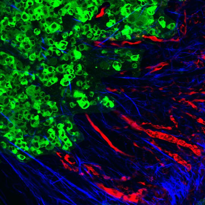 Paving the Way for Metastasis