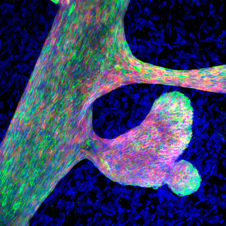 Aberrant mammary branching upon perturbed chromatin accessibility
