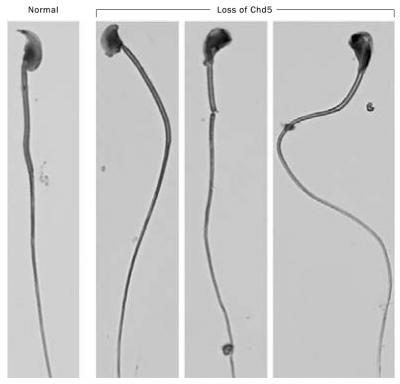 DNA Organization Is Critical for Male Fertility