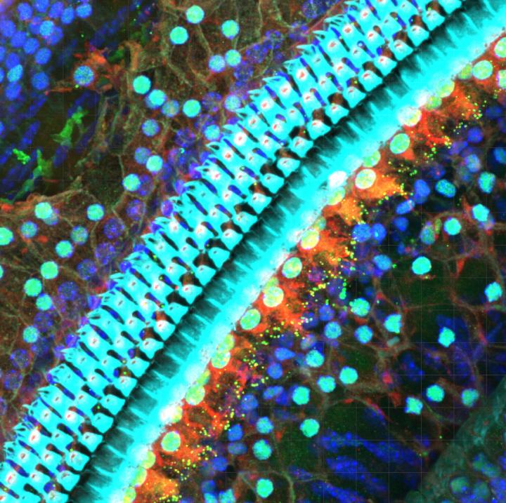Cochlea