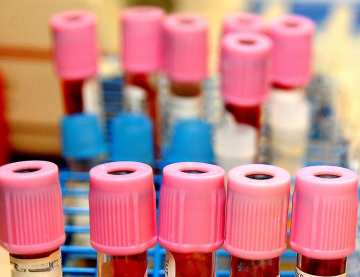 Study Gauges Impact of Dengue Virus on Ethiopia