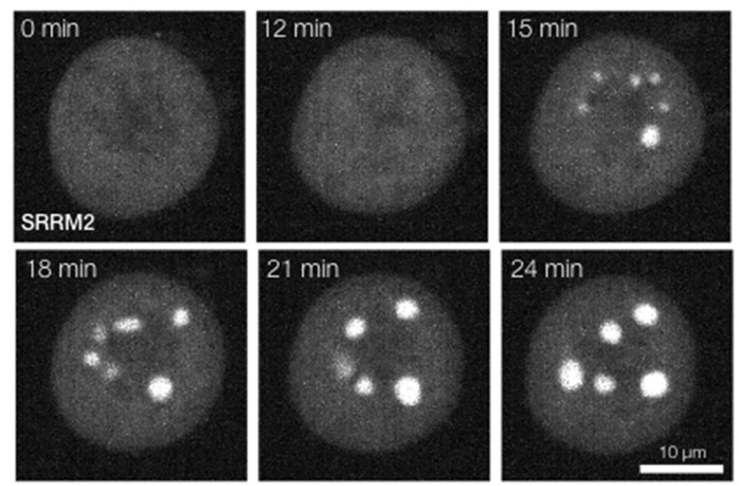 Phase Separation in Mitotic Cell