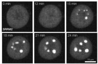 Phase Separation in Mitotic Cell