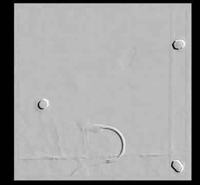 Gel Plugs Blood Vessels to Stem Bleeding (5 of 8)