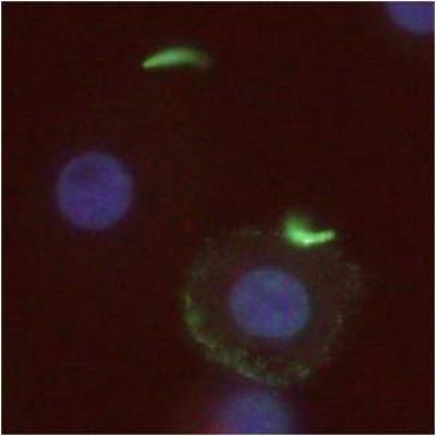 A New Era of Malaria Vaccine Development? (10 of 10)