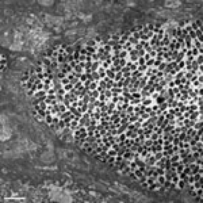 <i>S. sanguinis</i> 2 (of 2)