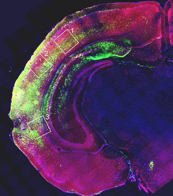 Rat's Brain