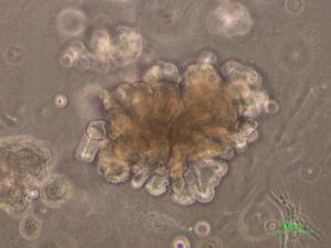 Human fetal kidney cells