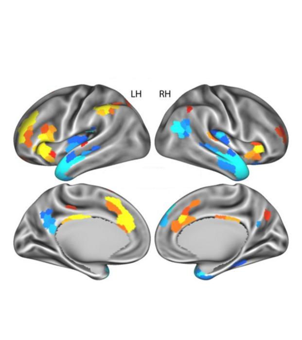 Aysha Brain Scan 1
