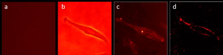 Figure 3. 2D edge detection demonstration of a phase object. (Human Umbilical Vein Endothelial cell).