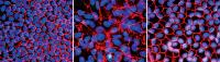 Diseased Retinal Cells are Treated with Gene Therapy