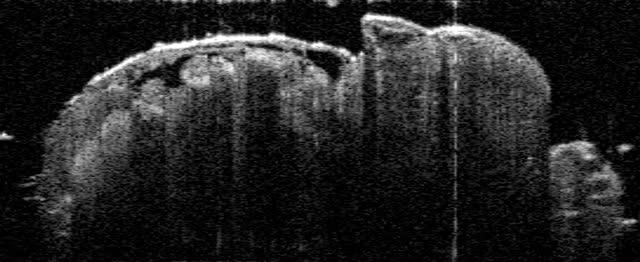 Beating Heart of a Fruit Fly