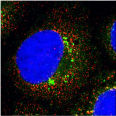 Hepatitis C Infecting a Cell
