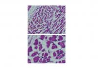 Figure 1. Abnormal muscle phenotype observed in neonates by overexpression of Rtl1.