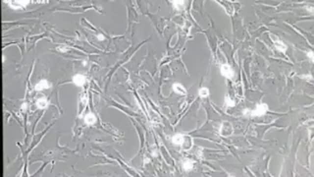 Targeting Telomeres, the Timekeepers of Cells, Could Improve Chemotherapy