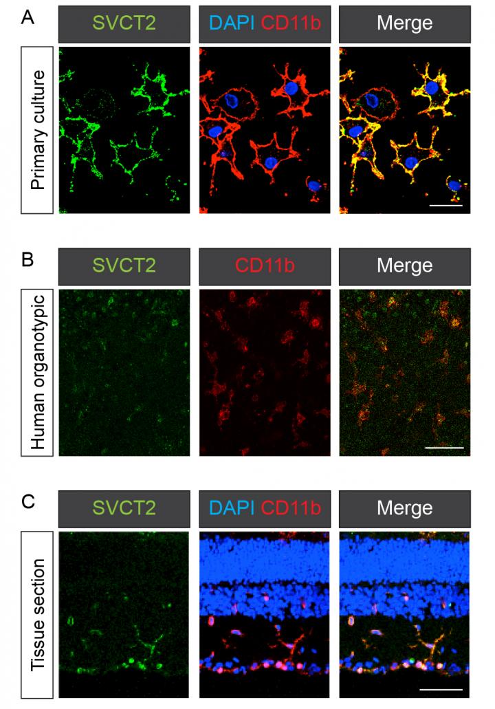 A Potential New Role for Vitamin C in Brain Inflammation (2 of 2)