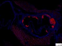 Aortic Root Plaques TACI -/-