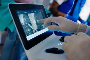 Robot assisted bronchoscopy 3