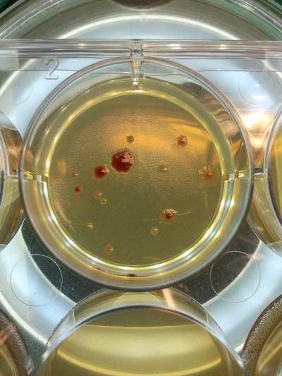 Mutated <em>E. coli</em> Bacteria (2 of 2)