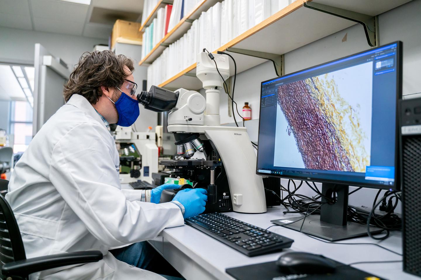 UK researcher Michael Franklin examines fibers in aortic tissue that are important to maintain the aorta's function.