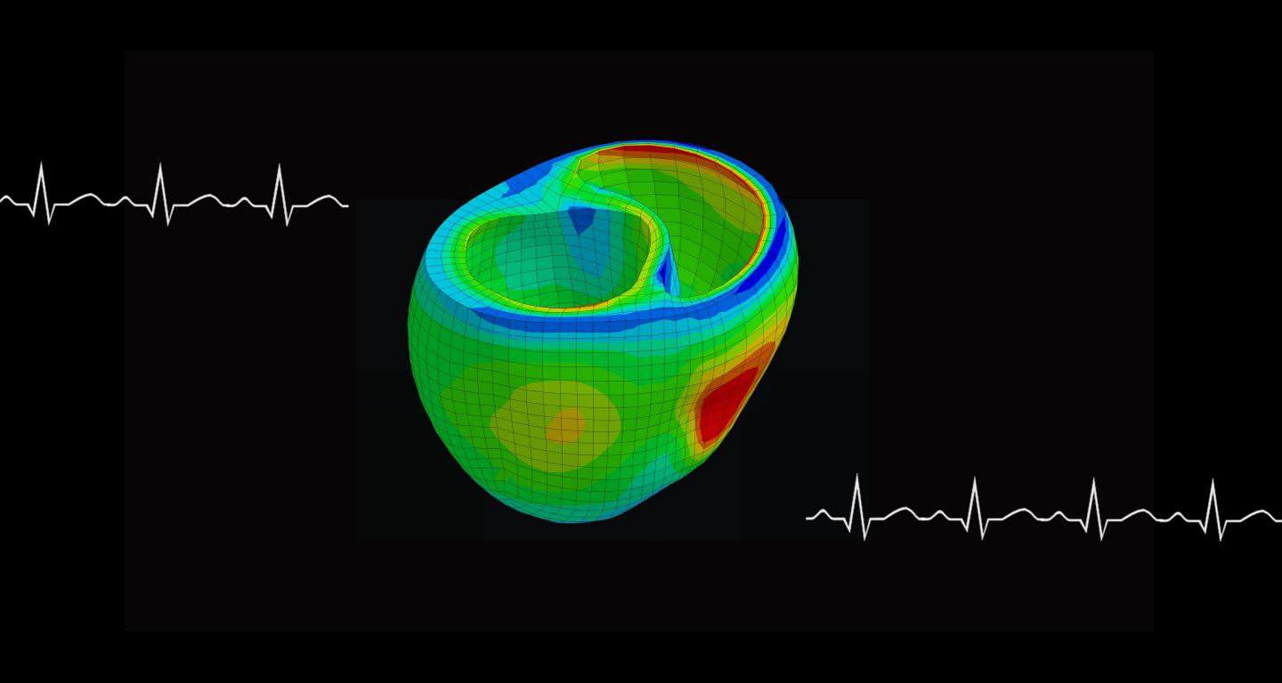 Computer Model of Heart