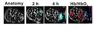 MSOT image of a tumour-bearing mouse demonstrating maximal uptake of GPc in 4h, overlayed on the anatomy and an Hb/HbO2 map in the same tumour, highlighting the low oxygen gradient in this tumour