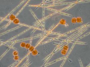 Harmful algal blooms