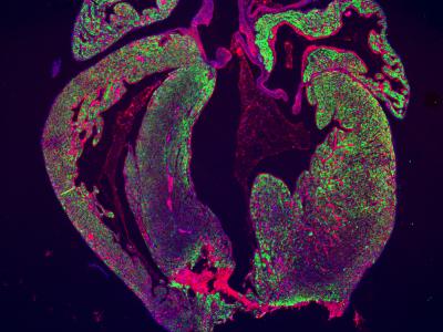 Apex Resected Heart at Day 7 after Surgery