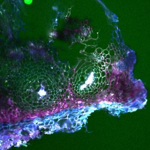 Pistachios under microscope