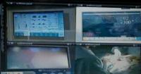 Patient Monitoring